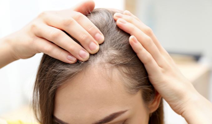 Hair Loss Banner 1 Hair Loss Banner 1